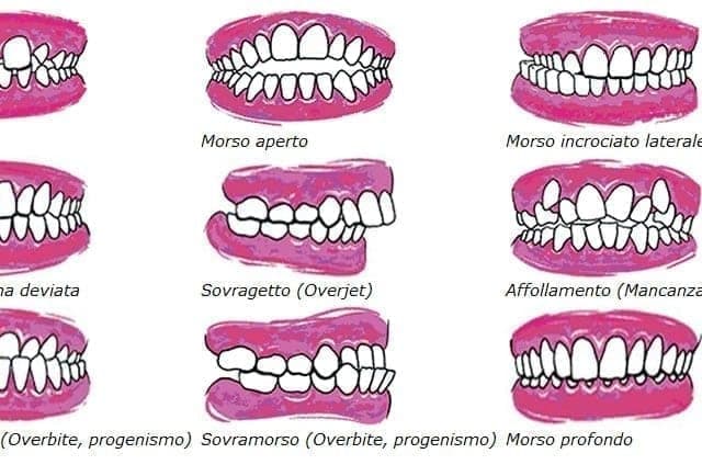 Come fare diagnosi ortodontica?