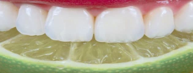 Cibi e bevande acide possono intaccare lo smalto dei denti?